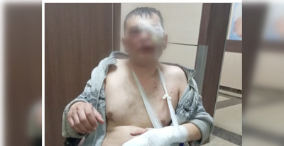 Бывшие коллеги жестоко избили лесника в Щучинске: что решил суд